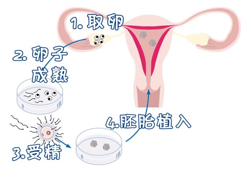 靠谱拉拉借卵助孕服务微信号